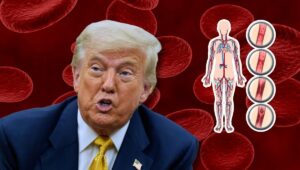 Donald Trump padece insuficiencia venosa crónica: ¿Qué implica esta condición y por qué genera preocupación? donald-trump-padece-insuficiencia-venosa-cronica-que-implica-esta-condicion-y-por-que-genera-preocupacion
